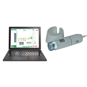 HD Hair Scalp Scope Skin Diagnosis Analyzer With Professional Analysis And