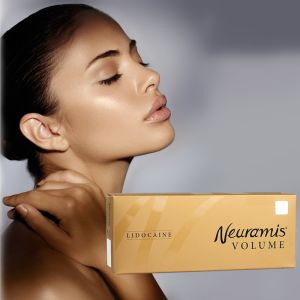 Remove Wrinkle Neuramis Dermal Filler 24 - 48 Hours Recovery Time