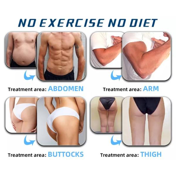 Electric Muscle Stimulation EMS EMShapeing Machine Weight Loss Fat Burn