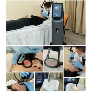 Co2 Laser 10600nm Laser Co2 Fractional Skin Resurfacing Machine