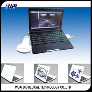 Wholesale Portable Pocket Color Doppler Handheld Ultrasound Scanner For All Kinds Of Application from china suppliers