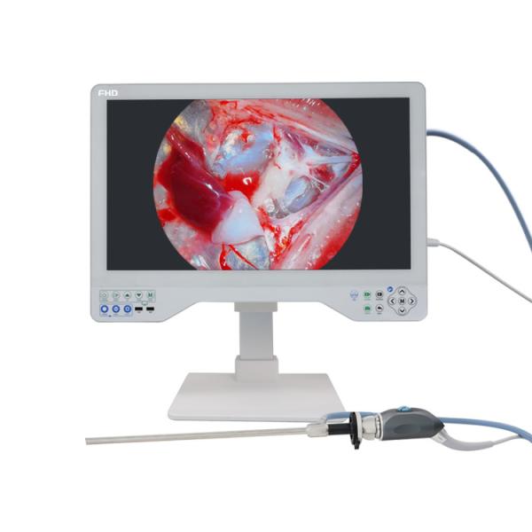Medical 24" FHD Laparoscopic Imaging System 80Watts LED Cold Light Source &
