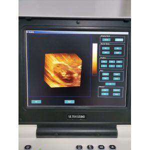 PW Ophthalmic Ultrasound Portable USG Machine Ultrasonography Machine