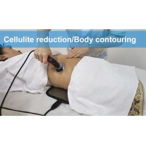 Ret Cet Indiba 448khz Diatermia Tecar Therapy Device Radio Frequency