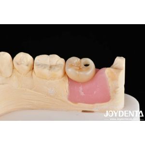 Precision Titanium Finished Abutments with Zero Angulation and Internal Hex