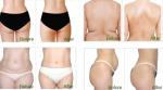 Super Cool System Fat Reduction Cryolipolysis Cool Body Sculpting Machine