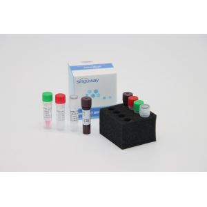 Buy cheap Treponema Pallidum TP Virus Fluorescent RT PCR Kit Fast HCV Real Time PCR Kit from wholesalers