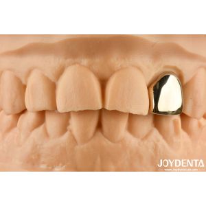 China Gold 60K Metallic Oral Crown Abrasion Resistant Dental Crown Wax Casting on sale