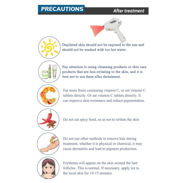 vertical professional diode laser 808nm hair removal machine / Newest Best price 808nm diode laser hair removal machine