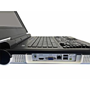 Windows7 Laptop Doppler Ultrasound Machine Imaging 12in With Dual Transducer