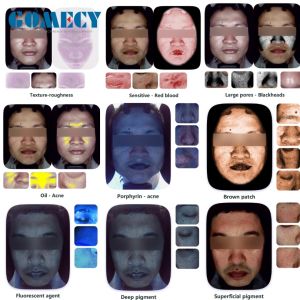 GMS- A6 Al Intelligent Face Analyzer Machine 8 Spectral Imaging Technologies for