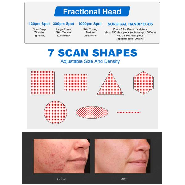 Newest 10600nm Co2 Fractional Laser Machine Fractional CO2 Laser Skin Resurfacing CO2 Laser Skin Tightening
