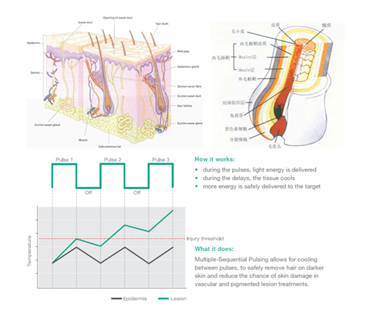 Partable Professional Hair Depilation Machines Lamp 300000 Shots Life Span