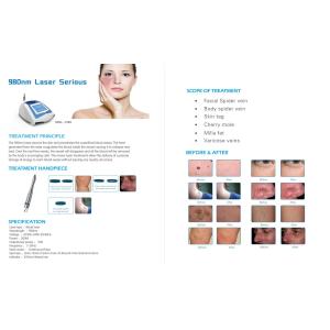 Professional & good effective 980nm diode laser spider veins removal diode laser