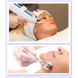 Hyaluronic Acid Mesotherapy Injection
