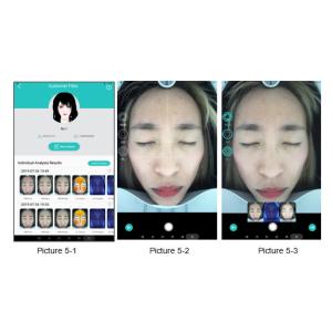 Digital Camera Analyzer Machine Doctors Skin Therapist Cosmetics