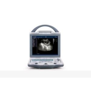 Mobile Ultrasound Scanner Portable Ultrasound Scanner with Transvaginal Linear