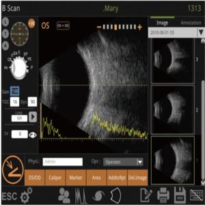 Mini Ultrasound Scanner Machine With Intelligent Digital Software Multiple IOL Calculation Formulas