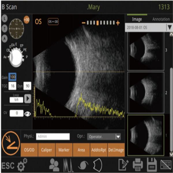 Quality Mini Ultrasound Scanner Machine With Intelligent Digital Software Multiple IOL Calculation Formulas for sale