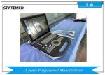 B Display Mode Color Doppler Ultrasound Scanner Convex Array 8 Segments TGC