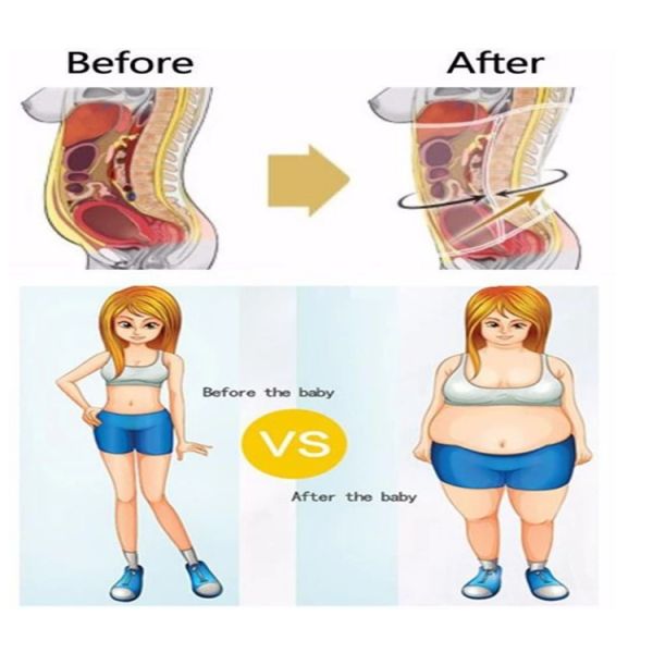 Elastic Postpartum Belly Belt Breathable Abdominal Binder Shaping Body Stature