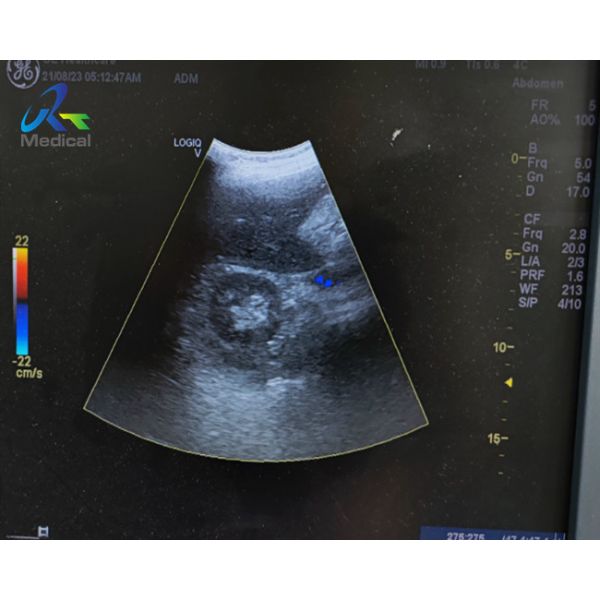 Quality GE 4C-RS Convex Probe Ultrasound Transducer Lens Replacement for sale