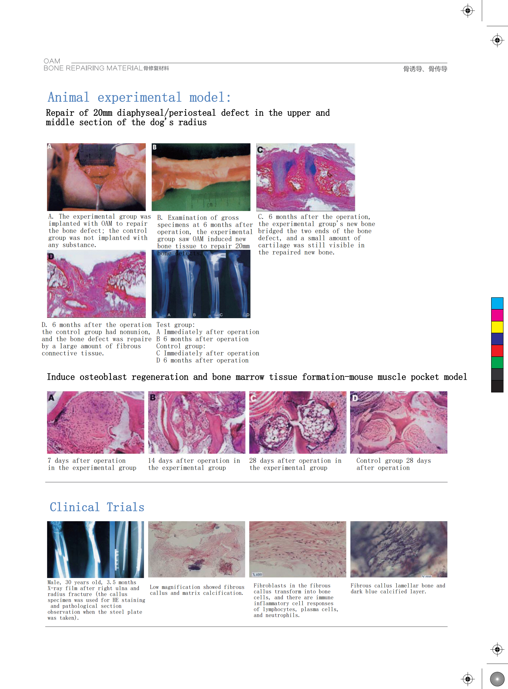 High Biological Activity Osteoinductive Bone Graft Materials With Complete Antigen Removal