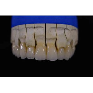 Wholesale Denture Fabrication Lab Achieving Perfectly White Dentures with Zirconia Repair from china suppliers