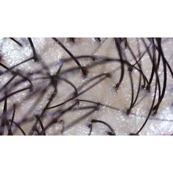 400nm 1080p Microscope Camera For Macbook UV Diammable Skin Detector