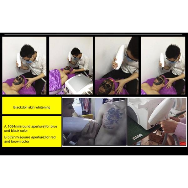 Single 6mm Laser Rod Q Switch Nd Yag Laser Tattoo Removal Ipl Handle