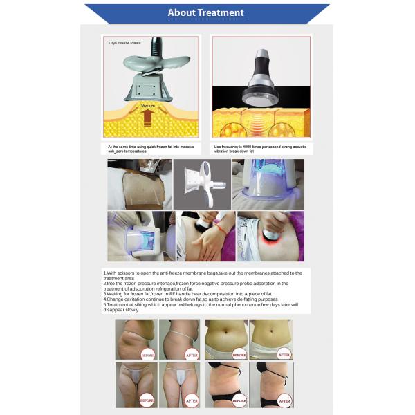 4 Handles Cryo Fat Freezing Machine 360 Cryotherapy Cryolipolysis Slimming Machine