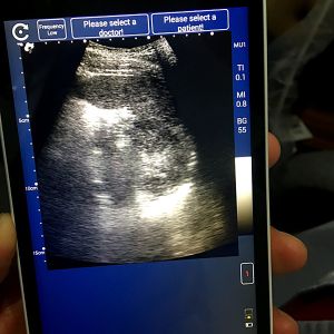 Handheld Ultrasound Scanner convex transducer