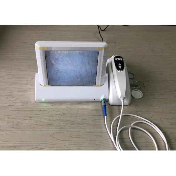 Handhled Digital Skin Moisture And Oil Analyzer With Professional Software