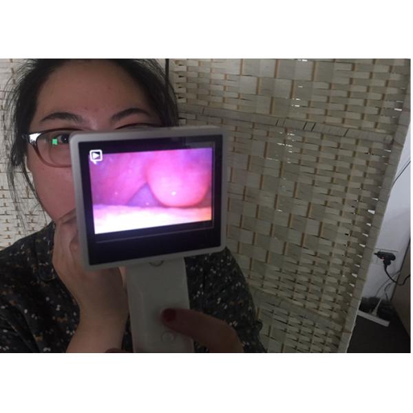 High Resolution Portable Endoscopy Larygoscope Rhinoscope And Digital Video