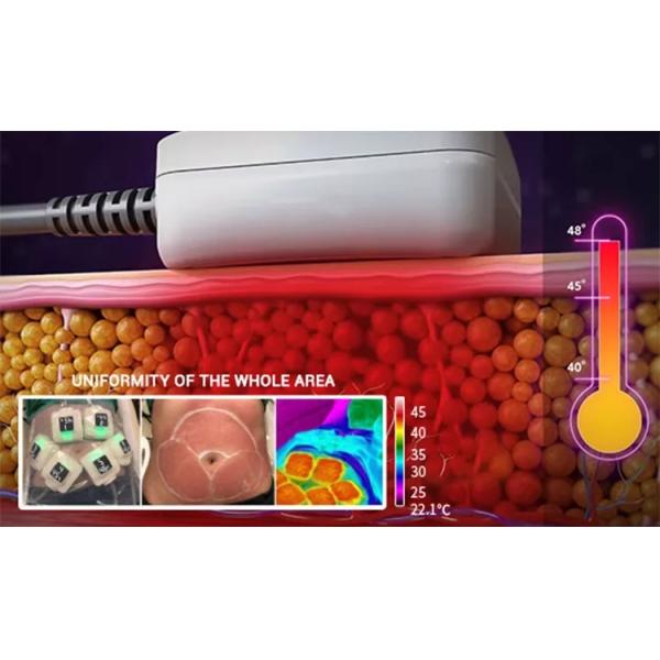 Portable Trusculpt Rf Beauty Machine 10 In 1 Skin Rejuvenation