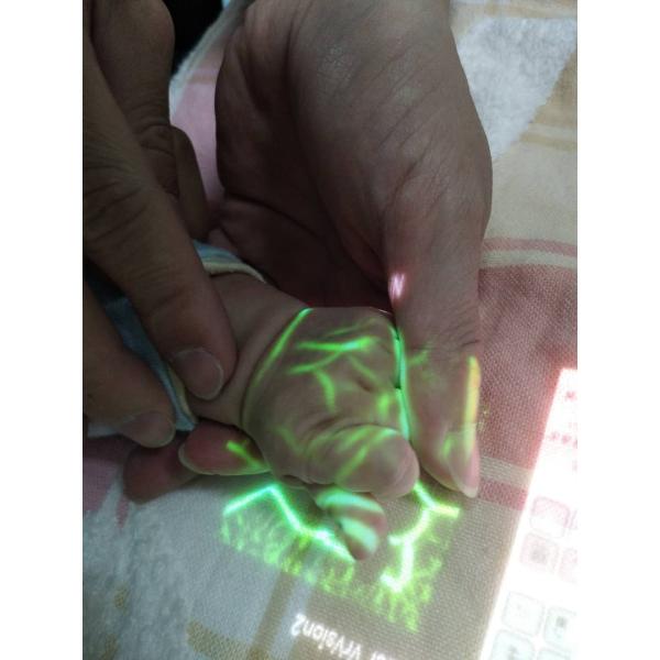 CE Handheld Smart Vein Finder 0.45kg Vein Locator Device