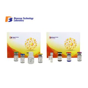 Wholesale Customized Human ELISA Kit Phosphofructokinase Muscle PFKM Strong Sensitivity from china suppliers
