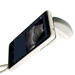 Handheld Ultrasound Scanner convex transducer