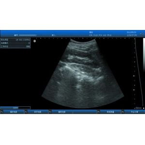 Popular 3D Digital Laptop Veterinary Ultrasound Scanner Lightweight Easy To