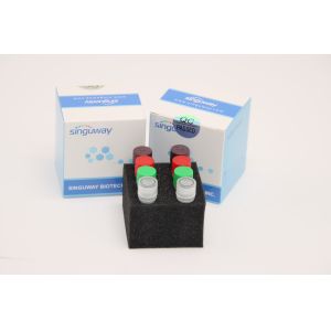 Buy cheap Fluorescent Real Time HCV RT PCR Kit HSV2 Test Kit Laboratory Use CE from wholesalers