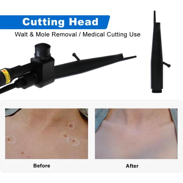 Newest 10600nm Co2 Fractional Laser Machine Fractional CO2 Laser Skin Resurfacing CO2 Laser Skin Tightening