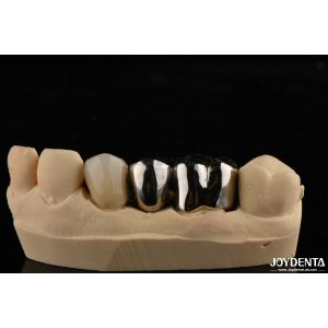 Wholesale Abrasion Resistant Metal Alloy Crown For Customized Dental Restorations from china suppliers