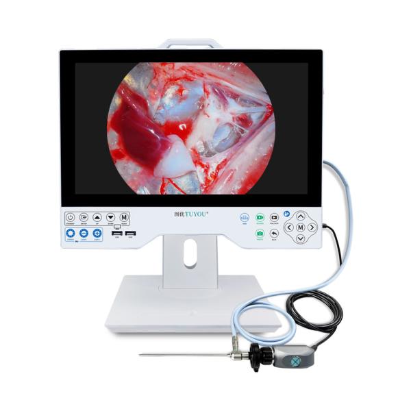 Quality 15.6 Inch Monitor All In One HD Endoscope Camera With Record Function For ENT Laparoscopy Hysteroscopy Urology for sale