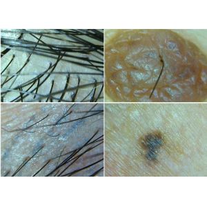 Wireless Microscope Digital Dermatoscope Connect To Computer For Skin And Hair