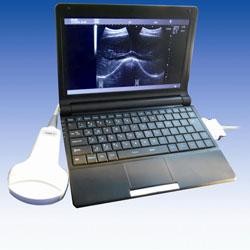 Mobile Ultrasound Machine Digital Laptop Ultrasound Scanner with 100 Frames