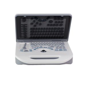 TGC Control Notebook Ultrasound Scanner For Pregnancy Home Use