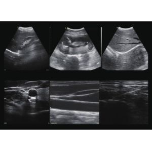 Ultrasonic Transducer Linear Convex Probe Handheld Ultrasound Scanner Wifi