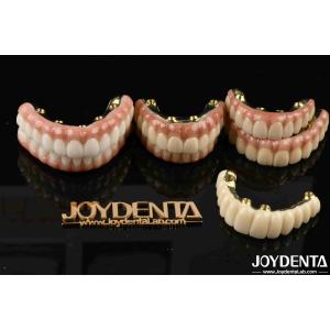 China Zirconia for Restoring Chewing Function Optimal Functionality Guaranteed on sale