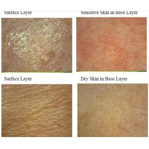 Wholesale Facial Uv Skin Analyzer Machine For Skin Mositure / Grease / Wrinkle / Pigmentation from china suppliers