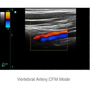 Ipad Ultrasonic Diagnostic Device Portable Ultrasound Scanner with 500G Image